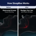 Anti-Snoring Device - SleepBee - Image 3